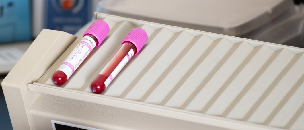 STD'S Screening & Testing